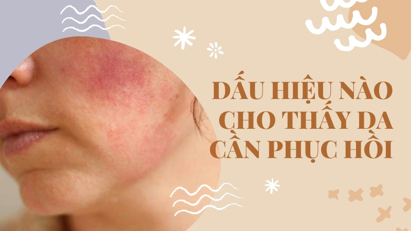 Dấu hiệu da lão hóa sớm và xỉn màu cảnh báo cần bổ sung dưỡng chất