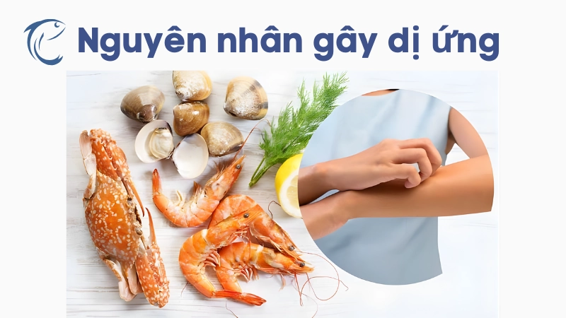 Nguyên nhân gây dị ứng và nhóm nguy cơ cao