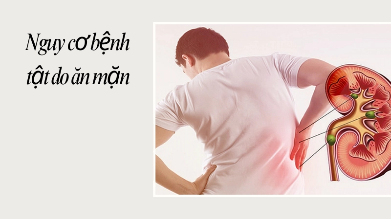 Ăn mặn lâu ngày làm tăng nguy cơ bệnh gì 