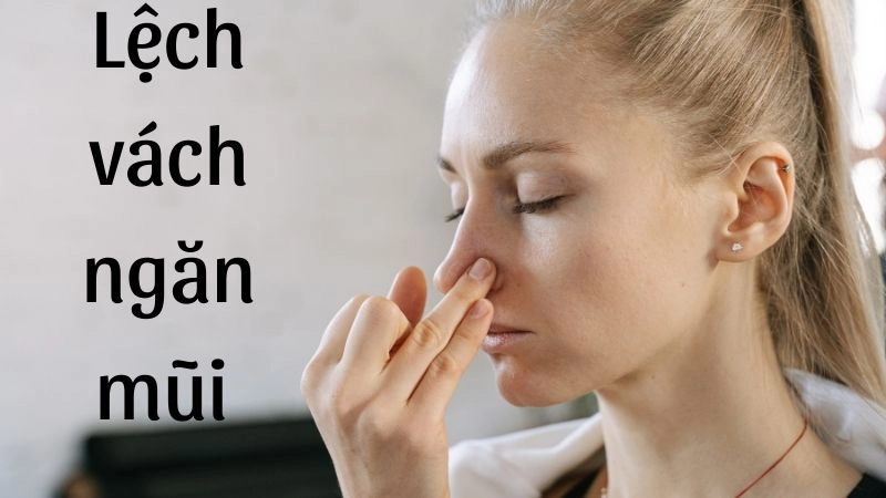 Dấu hiệu nhận biết lệch vách ngăn mũi điển hình