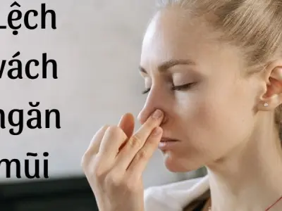 Lệch vách ngăn mũi và nguyên nhân nhiều người bỏ qua